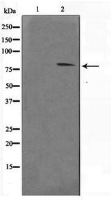 STAT1 Antibody - Western blot of STAT1 phosphorylation expression in MCF7 whole cell lysates,The lane on the left is treated with the antigen-specific peptide.