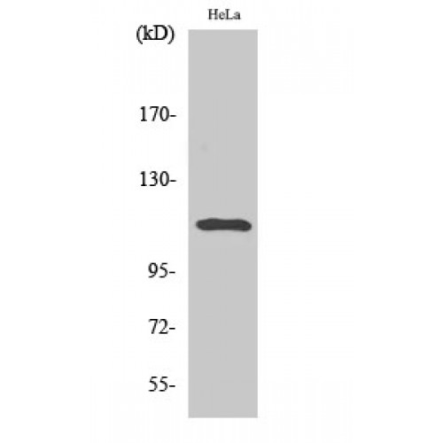 STAT2 Antibody - Western blot of Phospho-Stat2 (Y690) antibody