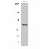 STAT2 Antibody - Western blot of Phospho-Stat2 (Y690) antibody