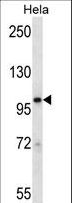 STAT2 Antibody - STAT2 Antibody western blot of HeLa cell line lysates (35 ug/lane). The STAT2 antibody detected the STAT2 protein (arrow).