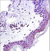 STAT2 Antibody - STAT2 Antibody immunohistochemistry of formalin-fixed and paraffin-embedded human skin tissue followed by peroxidase-conjugated secondary antibody and DAB staining.