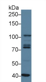 STAT2 Antibody - Western Blot; Sample: Human K562 cell lysate; Primary Ab: 3µg/ml Rabbit Anti-Human STAT2 Antibody Second Ab: 0.2µg/mL HRP-Linked Caprine Anti-Rabbit IgG Polyclonal Antibody
