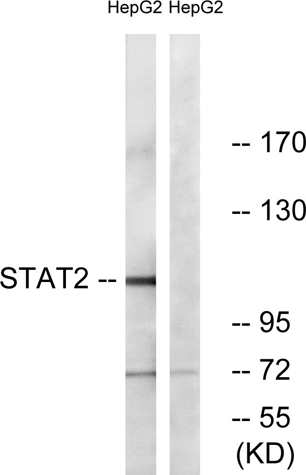 STAT2 Antibody - Western blot analysis of lysates from HepG2, using STAT2 Antibody. The lane on the right is blocked with the synthesized peptide.