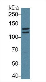 STAT2 Antibody - Western Blot; Sample: Mouse Cerebrum lysate; Primary Ab: 1µg/ml Rabbit Anti-Mouse STAT2 Antibody Second Ab: 0.2µg/mL HRP-Linked Caprine Anti-Rabbit IgG Polyclonal Antibody