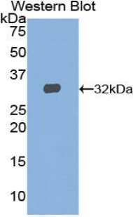STAT2 Antibody - Western blot of recombinant STAT2.  This image was taken for the unconjugated form of this product. Other forms have not been tested.