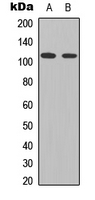 STAT2 Antibody - Western blot analysis of STAT2 (pY690) expression in HeLa (A); K562 (B) whole cell lysates.