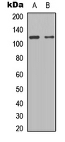 STAT2 Antibody - Western blot analysis of STAT2 expression in HeLa (A); HepG2 (B) whole cell lysates.