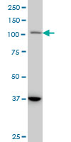 STAT2 Antibody - STAT2 monoclonal antibody (M01), clone 5G7 Western Blot analysis of STAT2 expression in A-431.