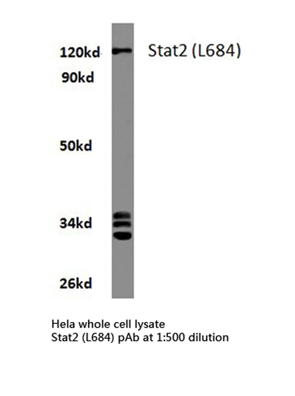 STAT2 Antibody - Western blot of STAT2 (L684) pAb in extracts from HeLa cells.