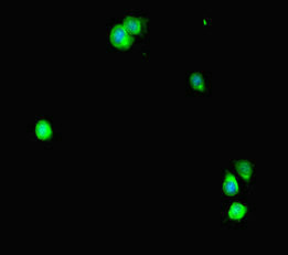 STAT2 Antibody - Immunofluorescent analysis of HeLa cells diluted at 1:100 and Alexa Fluor 488-congugated AffiniPure Goat Anti-Rabbit IgG(H+L)
