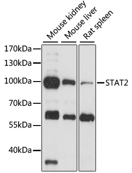STAT2 Antibody - Western blot analysis of extracts of various cell lines, using STAT2 antibody at 1:1000 dilution. The secondary antibody used was an HRP Goat Anti-Rabbit IgG (H+L) at 1:10000 dilution. Lysates were loaded 25ug per lane and 3% nonfat dry milk in TBST was used for blocking. An ECL Kit was used for detection and the exposure time was 60s.