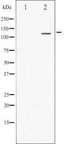 STAT2 Antibody - Western blot analysis of STAT2 expression in IFN treated HeLa whole cells lysates. The lane on the left is treated with the antigen-specific peptide.