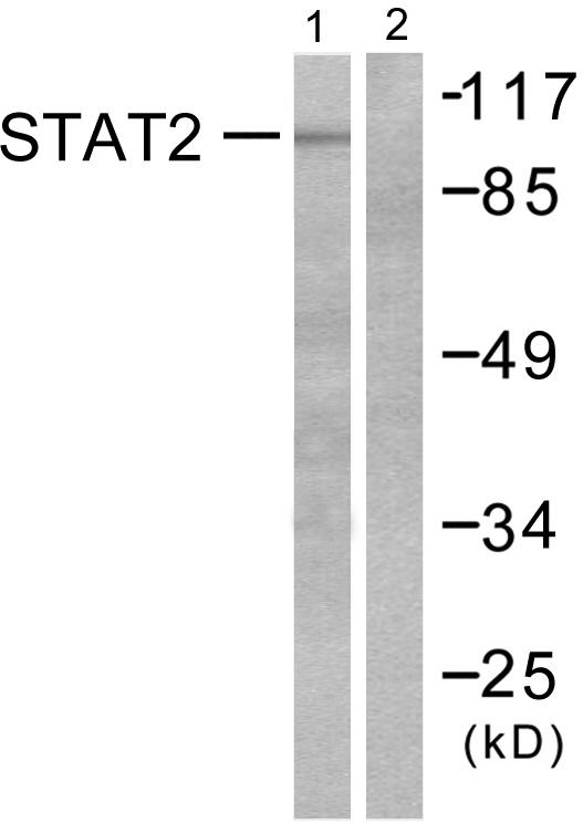 STAT2 Antibody - Western blot analysis of extracts from HeLa cells treated with IFN (2500U/ml, 30mins), using STAT2 (Ab-690) antibody.