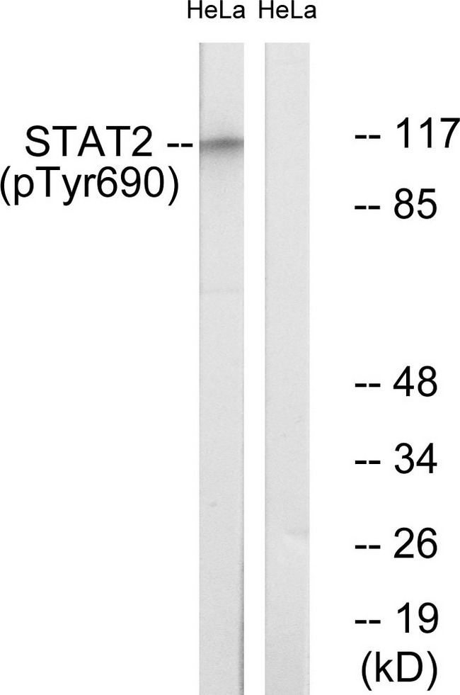 STAT2 Antibody - Western blot analysis of lysates from HeLa cells treated with IFN 2500U/ml 30', using STAT2 (Phospho-Tyr690) Antibody. The lane on the right is blocked with the phospho peptide.