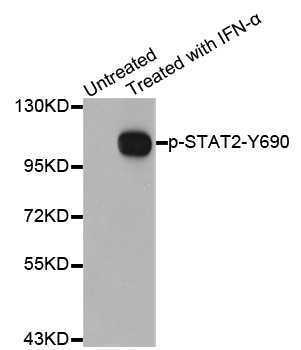STAT2 Antibody - Western blot analysis of extracts from Hela cells.