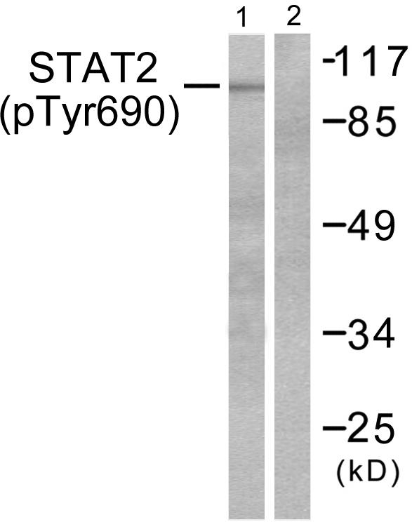 STAT2 Antibody - Western blot analysis of extracts from HeLa cells treated with IFN (2500U/ml, 30mins), using STAT2 (Phospho-Tyr690) antibody.