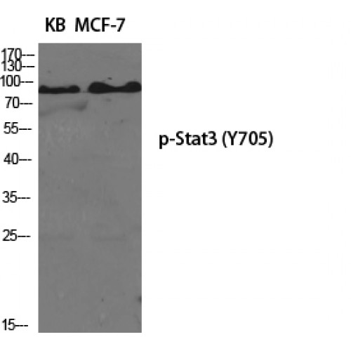STAT3 Antibody - Western blot of Phospho-Stat3 (Y705) antibody