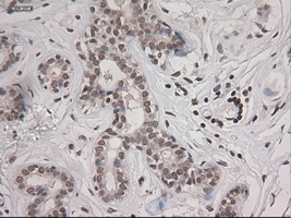STAT3 Antibody - IHC of paraffin-embedded breast using anti-STAT3 mouse monoclonal antibody.