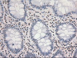 STAT3 Antibody - IHC of paraffin-embedded colon using anti-STAT3 mouse monoclonal antibody.