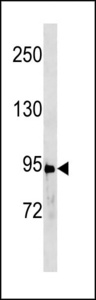 STAT3 Antibody - Stat3 (C-term Tyr705) Antibody western blot of A431 cell line lysates (35 ug/lane). The Stat3 (Tyr705) antibody detected the Stat3 (Tyr705) protein (arrow).