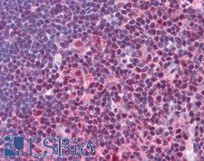 STAT3 Antibody - Anti-STAT3 antibody IHC of human thymus. Immunohistochemistry of formalin-fixed, paraffin-embedded tissue after heat-induced antigen retrieval. Antibody concentration 5 ug/ml.  This image was taken for the unconjugated form of this product. Other forms have not been tested.