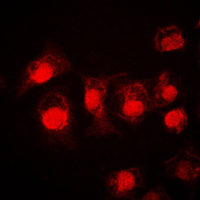 STAT3 Antibody - Immunofluorescent analysis of STAT3 staining in A549 cells. Formalin-fixed cells were permeabilized with 0.1% Triton X-100 in TBS for 5-10 minutes and blocked with 3% BSA-PBS for 30 minutes at room temperature. Cells were probed with the primary antibody in 3% BSA-PBS and incubated overnight at 4 C in a humidified chamber. Cells were washed with PBST and incubated with a DyLight 594-conjugated secondary antibody (red) in PBS at room temperature in the dark. DAPI was used to stain the cell nuclei (blue).