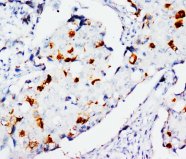 STAT3 Antibody -  This image was taken for the unconjugated form of this product. Other forms have not been tested.