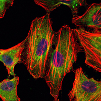STAT3 Antibody - Immunofluorescence of HeLa cells using STAT3 mouse monoclonal antibody (green). Blue: DRAQ5 fluorescent DNA dye. Red: Actin filaments have been labeled with Alexa Fluor-555 phalloidin.