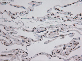 STAT3 Antibody - IHC of paraffin-embedded lung using anti-STAT3 mouse monoclonal antibody.