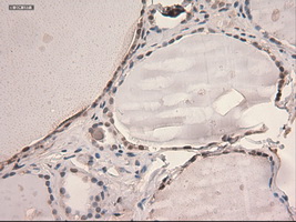 STAT3 Antibody - IHC of paraffin-embedded thyroid using anti-STAT3 mouse monoclonal antibody.