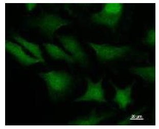 STAT3 Antibody - Immunofluorescent staining using STAT3 antibody. Immunostaining analysis in HeLa cells. HeLa cells were fixed with 4% paraformaldehyde and permeabilized with 0.01% Triton-X100 in PBS. The cells were immunostained with anti-STAT3 antibody.