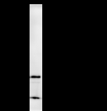 STAT3 Antibody - Immunoprecipitation: RIPA lysate of HeLa cells was incubated with anti-STAT3 mAb. Predicted molecular weight: 87 kDa