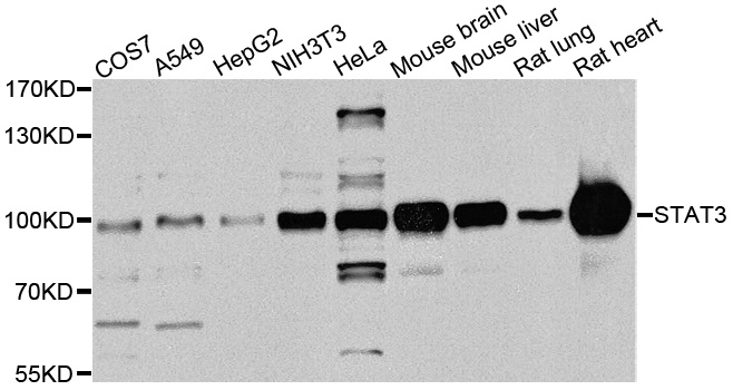 STAT3 Antibody - Western blot analysis of extracts of various cell lines, using STAT3 antibody at 1:1000 dilution. The secondary antibody used was an HRP Goat Anti-Rabbit IgG (H+L) at 1:10000 dilution. Lysates were loaded 25ug per lane and 3% nonfat dry milk in TBST was used for blocking. An ECL Kit was used for detection and the exposure time was 30s.