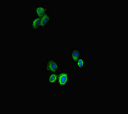 STAT3 Antibody - Immunofluorescent analysis of HepG-2 cells diluted at 1:100 and Alexa Fluor 488-congugated AffiniPure Goat Anti-Rabbit IgG(H+L)