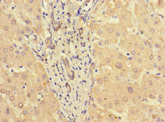 STAT3 Antibody - Immunohistochemistry of paraffin-embedded human liver tissue at dilution 1:100