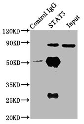 STAT3 Antibody - Immunoprecipitating STAT3 in Hela whole cell lysate Lane 1: Rabbit control IgG (1µg) instead of product in Hela whole cell lysate.For western blotting,a HRP-conjugated Protein G antibody was used as the Secondary antibody (1/2000) Lane 2: product (6µg) + Hela whole cell lysate (500µg) Lane 3: Hela whole cell lysate (10µg)