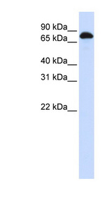 STAT3 Antibody - STAT3 antibody Western blot of Fetal Liver lysate. This image was taken for the unconjugated form of this product. Other forms have not been tested.