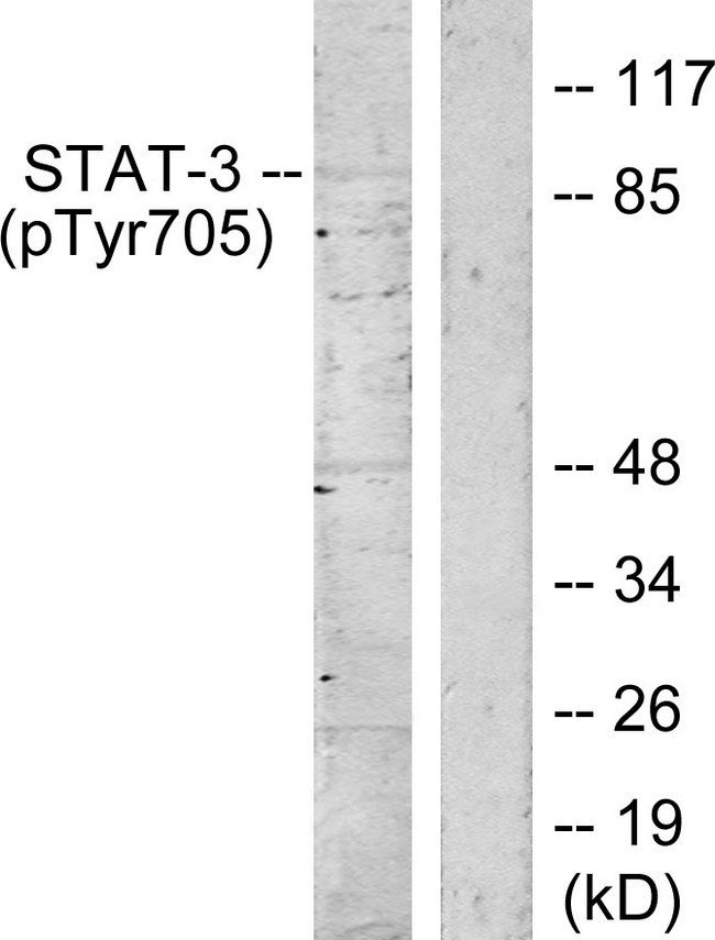 STAT3 Antibody - Western blot analysis of lysates from HeLa cells, using STAT3 (Phospho-Tyr705) Antibody. The lane on the right is blocked with the phospho peptide.