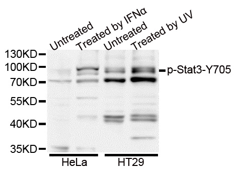 STAT3 Antibody - Western blot analysis of extracts of various cell lines.