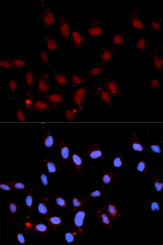 STAT3 Antibody - Immunofluorescence analysis of U2OS cells.