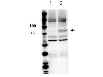 STAT3 Antibody - Western Blot of rabbit anti-Stat3 pY705 antibody. Lane 1: Jurkat lysate. Lane 2: Jurkat lysate IFN-a treatment. Load: 35 µg per lane. Primary antibody: STAT3 pY705 antibody at 1:1000 for overnight at 4°C. Secondary antibody: rabbit secondary antibody at 1:10,000 for 45 min at RT. Block: 5% BLOTTO overnight at 4°C. Predicted/Observed size: 88 kDa, ~90kDa for STAT3py705. Other band(s): STAT 3 pY705 splice variants and isoforms.