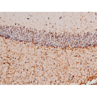 STAT3 Antibody - 1:200 staining mouse brain tissue by IHC-P. The tissue was formaldehyde fixed and a heat mediated antigen retrieval step in citrate buffer was performed. The tissue was then blocked and incubated with the antibody for 1.5 hours at 22°C. An HRP conjugated goat anti-rabbit antibody was used as the secondary.