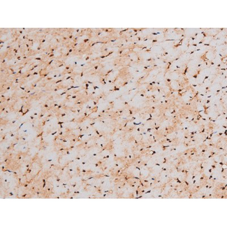 STAT3 Antibody - 1:200 staining mouse heart tissue by IHC-P. The tissue was formaldehyde fixed and a heat mediated antigen retrieval step in citrate buffer was performed. The tissue was then blocked and incubated with the antibody for 1.5 hours at 22°C. An HRP conjugated goat anti-rabbit antibody was used as the secondary.