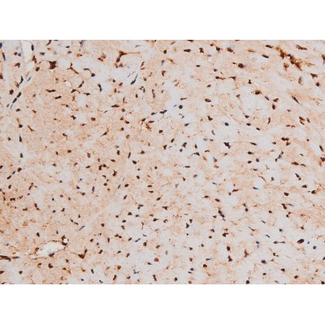 STAT3 Antibody - 1:200 staining mouse heart tissue by IHC-P. The tissue was formaldehyde fixed and a heat mediated antigen retrieval step in citrate buffer was performed. The tissue was then blocked and incubated with the antibody for 1.5 hours at 22°C. An HRP conjugated goat anti-rabbit antibody was used as the secondary.