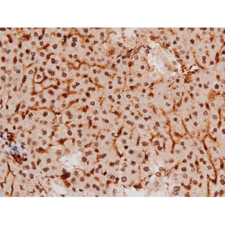 STAT3 Antibody - 1:200 staining mouse liver tissue by IHC-P. The tissue was formaldehyde fixed and a heat mediated antigen retrieval step in citrate buffer was performed. The tissue was then blocked and incubated with the antibody for 1.5 hours at 22°C. An HRP conjugated goat anti-rabbit antibody was used as the secondary.