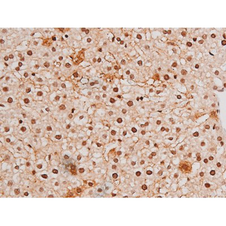 STAT3 Antibody - 1:200 staining rat liver tissue by IHC-P. The tissue was formaldehyde fixed and a heat mediated antigen retrieval step in citrate buffer was performed. The tissue was then blocked and incubated with the antibody for 1.5 hours at 22°C. An HRP conjugated goat anti-rabbit antibody was used as the secondary.