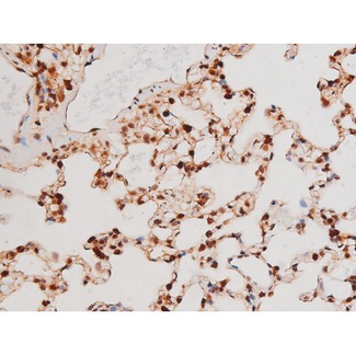 STAT3 Antibody - 1:200 staining rat lung tissue by IHC-P. The tissue was formaldehyde fixed and a heat mediated antigen retrieval step in citrate buffer was performed. The tissue was then blocked and incubated with the antibody for 1.5 hours at 22°C. An HRP conjugated goat anti-rabbit antibody was used as the secondary.