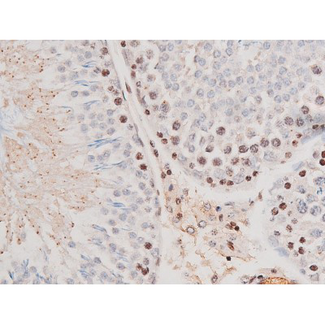 STAT3 Antibody - 1:200 staining rat testis tissue by IHC-P. The tissue was formaldehyde fixed and a heat mediated antigen retrieval step in citrate buffer was performed. The tissue was then blocked and incubated with the antibody for 1.5 hours at 22°C. An HRP conjugated goat anti-rabbit antibody was used as the secondary.