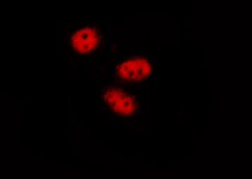 STAT3 Antibody - Staining LOVO cells by IF/ICC. The samples were fixed with PFA and permeabilized in 0.1% Triton X-100, then blocked in 10% serum for 45 min at 25°C. The primary antibody was diluted at 1:200 and incubated with the sample for 1 hour at 37°C. An Alexa Fluor 594 conjugated goat anti-rabbit IgG (H+L) Ab, diluted at 1/600, was used as the secondary antibody.