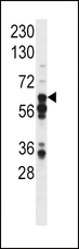 STAT3 Antibody - Western blot of anti-Phospho-STAT3 Pabin mouse liver tissue lysate (35 ug/lane). Phospho-STAT3(arrow) was detected using the purified antibody.